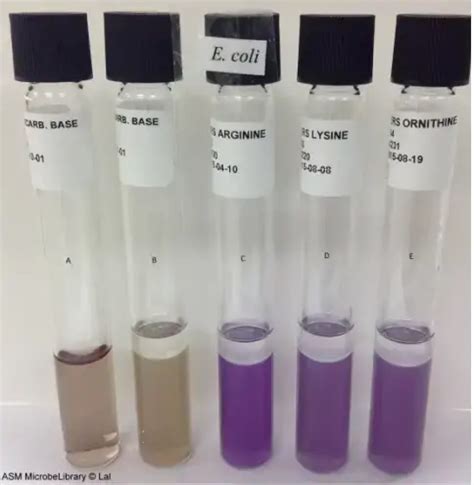 ornithine decarboxylase media.